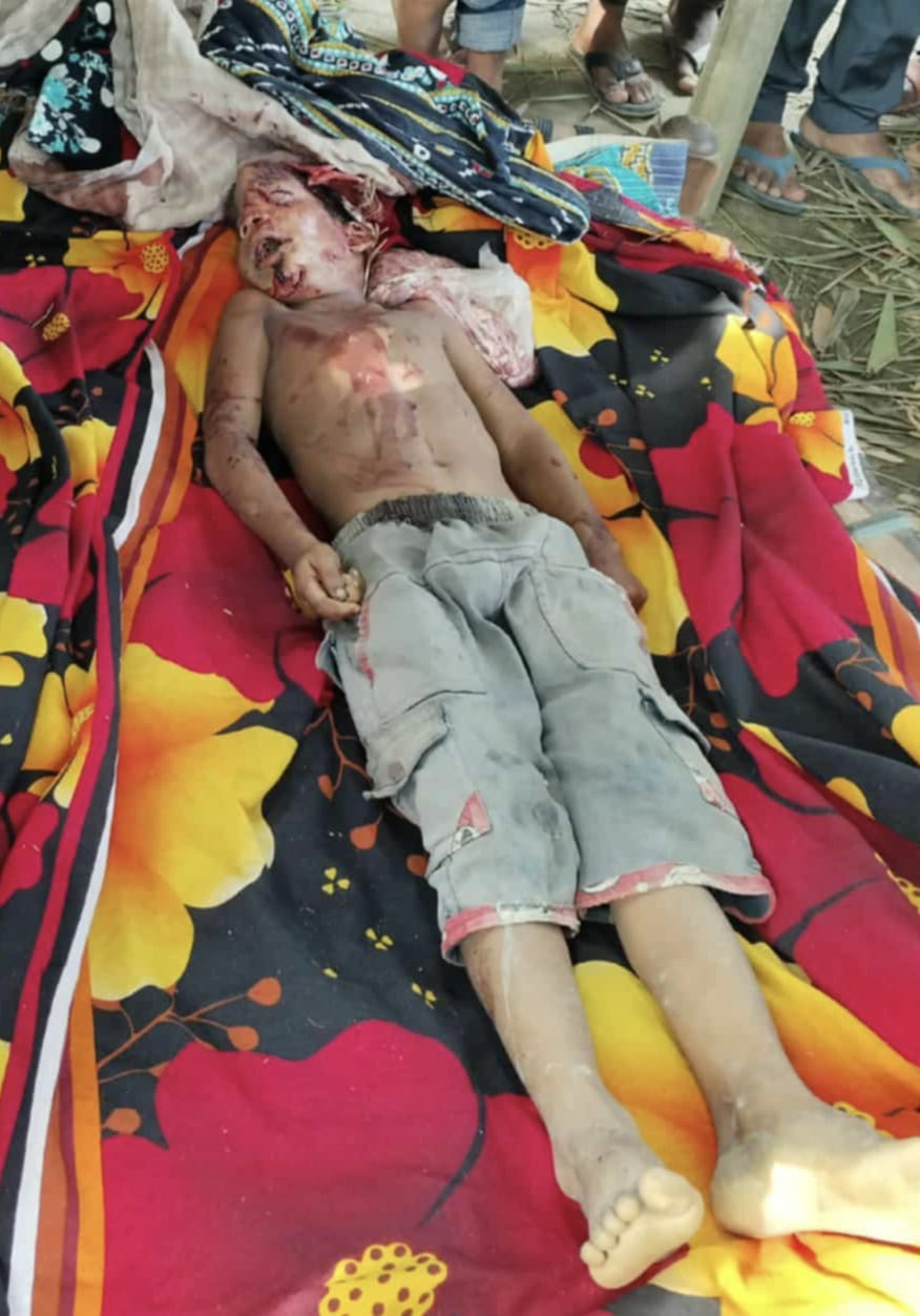 নিয়ামতপুরে ভটভটির চাকায় পিষ্ট হয়ে প্রাণ গেল শিশু শহীদের